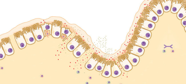 Leaky gut, permeabilidad intestinal aumentada